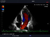 常盤台（ときわ台）近く夜間救急対応の犬猫専門動物病院の上板橋リズ犬猫病院の心臓エコー（超音波検査）の図